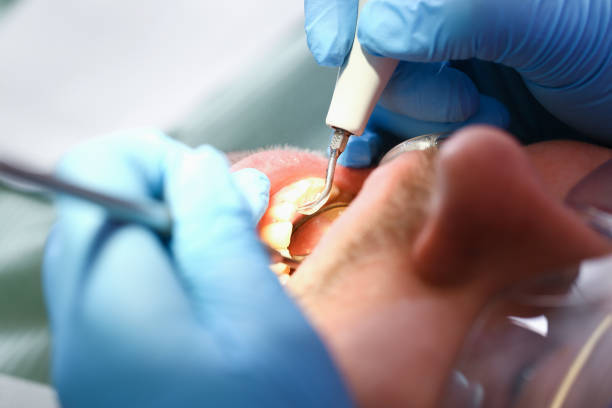 Best Mobile Emergency Dentist in Lincoln Village, OH