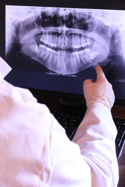 Best Emergency Dental Extractions in Lincoln Village, OH