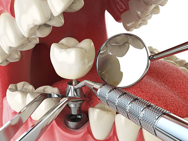 Best Orthodontic Emergency Dentist in Lincoln Village, OH